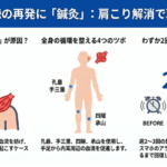 「また耳が詰まってきた…」を繰り返している方への詳細へ